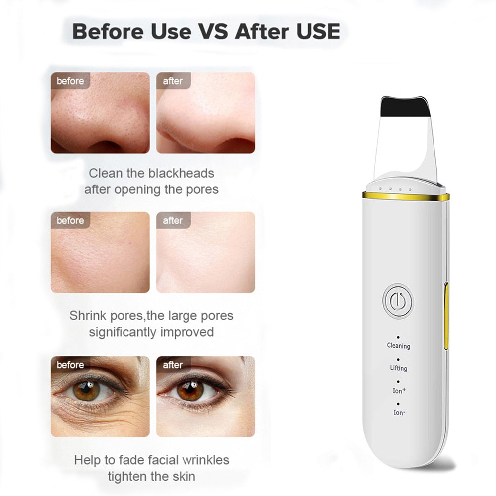 Ultrasonic Skin Scrubber